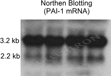 Northern blot